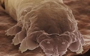 Demodex mites and human skin - Ozderm