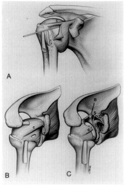 Structure of coracohumeral ligament | Semantic Scholar