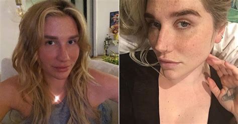 Photos of Kesha With No Makeup | POPSUGAR Beauty