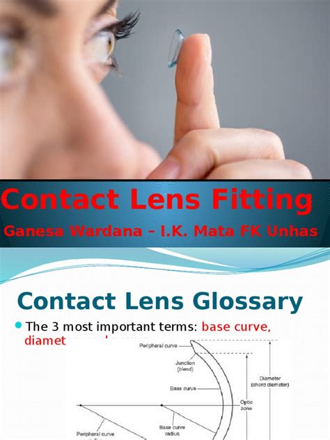 Contact Lens Fitting | Contact Lens | Lens (Optics)