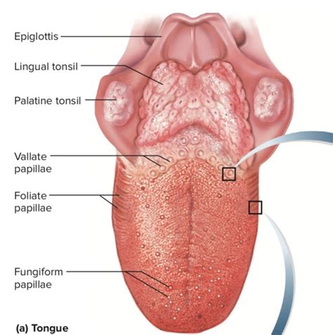 Swollen Taste Buds on Tongue