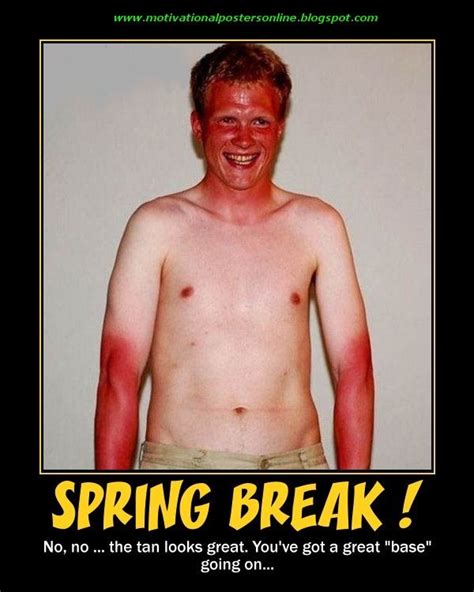 Funny Spring - Bing Images | Funny sunburn, Ginger jokes, Bad sunburn