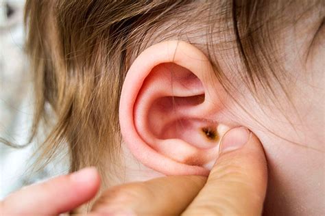 How To Clean Baby Earwax: Safety And When To See A Doctor