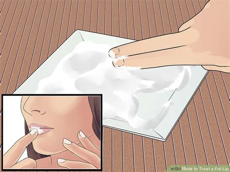 How to Treat a Fat Lip: 14 Steps (with Pictures) - wikiHow