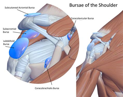 BURSITIS - Coastal Virginia Spine & Pain Center