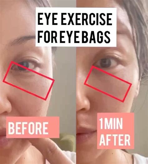 Health and Beauty by U on Instagram: “ Eye exercise / massage for Eye ...