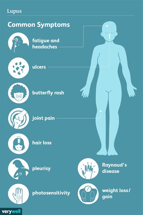 Lupus: Signs, Symptoms, and Complications