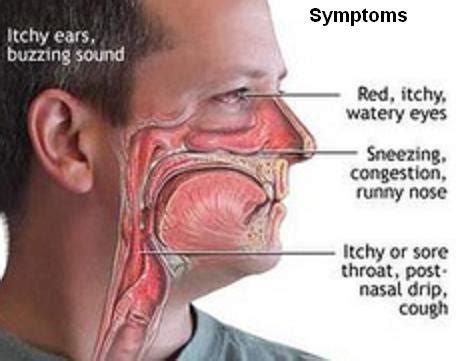 Why Construction Workers Need to Be Wary of Weil’s Disease