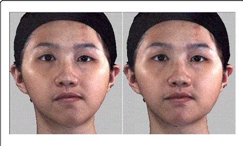 Facial symmetry plastic surgery – Telegraph