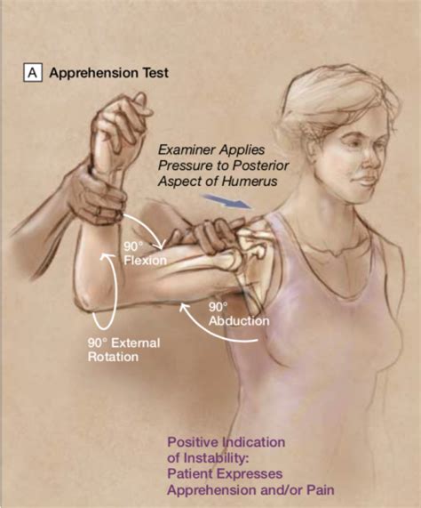 Posterior Shoulder Pain Diagnosis Chart - Best Picture Of Chart ...