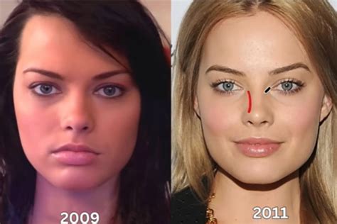 How many plastic surgeries did Margot Robbie get done to look like the iconic Barbie doll? | Marca