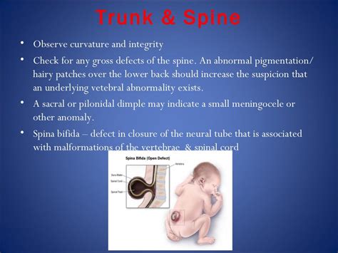 Newborn examination