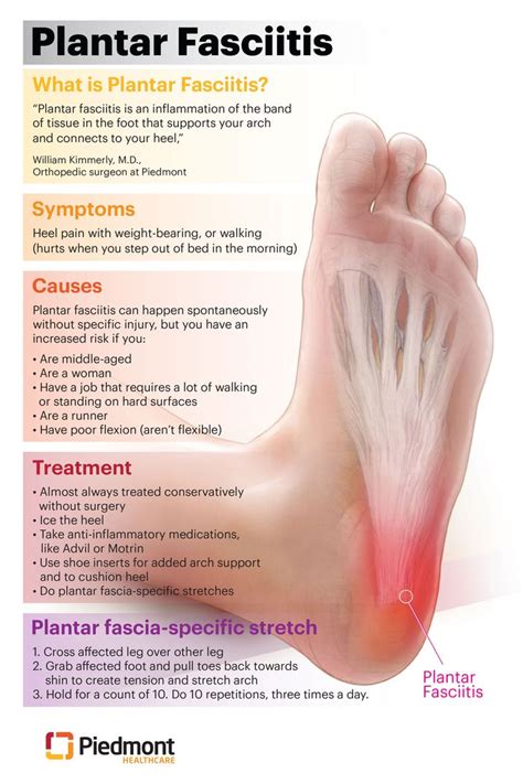 Plantar Fasciitis Symptoms and Treatments | Piedmont Healthcare | What ...