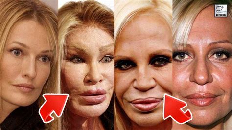 Here is the list of celebrities whose surgery has gone seriously wrong ...