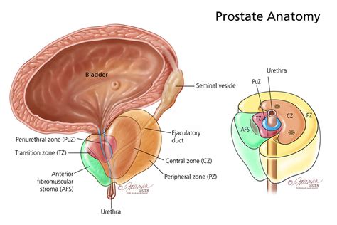 Prostatitis (Infection of the Prostate): Symptoms, Diagnosis ...