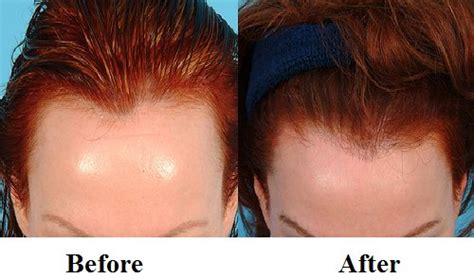 49+ Does Biotin Help Hair Growth PNG - electricshopheaterbuyy