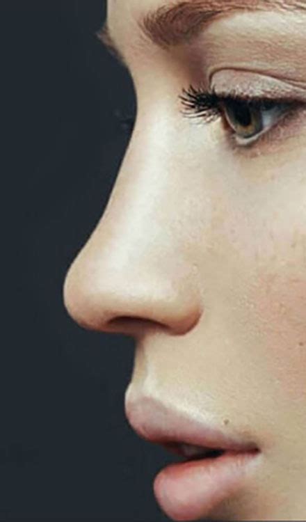 See why local and out-of-town patients choose top rhinoplasty surgeon, Dr. Rizk, for their nose ...