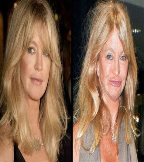 Top 10 Celebs That Became Super Ugly After Plastic Su - vrogue.co