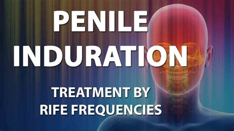 Penile Induration - RIFE Frequencies Treatment - Energy & Quantum Medicine with Bioresonance ...