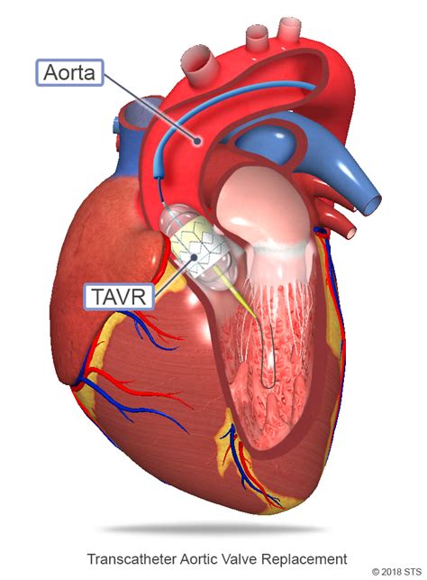 Atrioventricular Valve