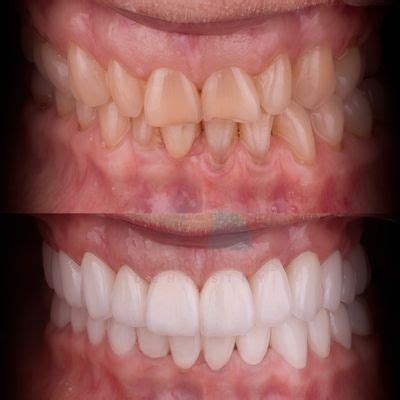 ADVANCED SMILES DENTISTRY - Updated July 2024 - 219 Photos & 249 Reviews - German Gedovius 10489 ...