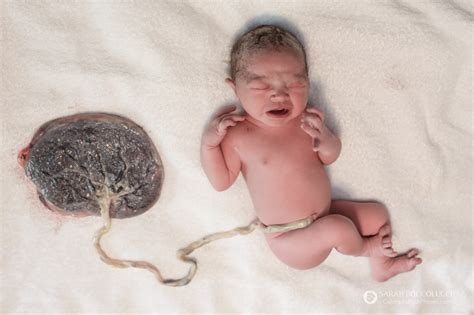 Colorado-Birth-Photos-Baby-Connected-To-Placenta - Colorado Birth ...