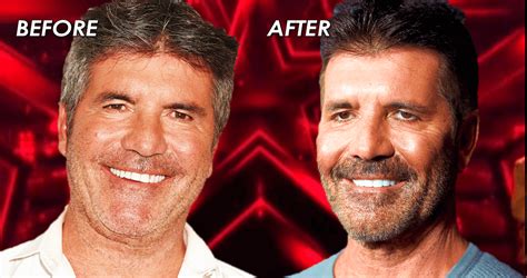 ‘AGT’ Fans Shook: Is Simon Cowell’s New Face Due To Vegan Diet Or Botox? Britain’s Got Talent ...