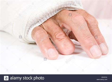 Ring Finger Injury Stock Photos & Ring Finger Injury Stock Images - Alamy