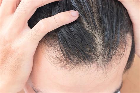 Diffuse Thinning: What It Is, And What You Can Do About It