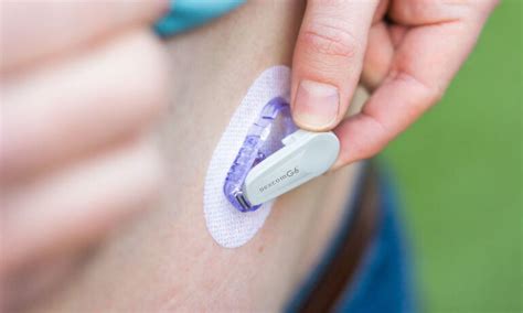 Dexcom G6 pour un suivi précis et en temps réel du diabète ...