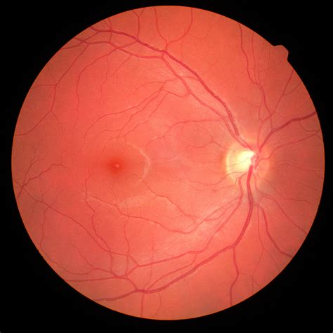 Mácula ocular: qué es y por qué es tan importante para la visión - Ejercicio para la salud