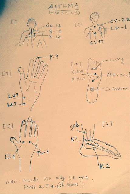 SaroEpic Acupuncture : Acupuncture points for asthma