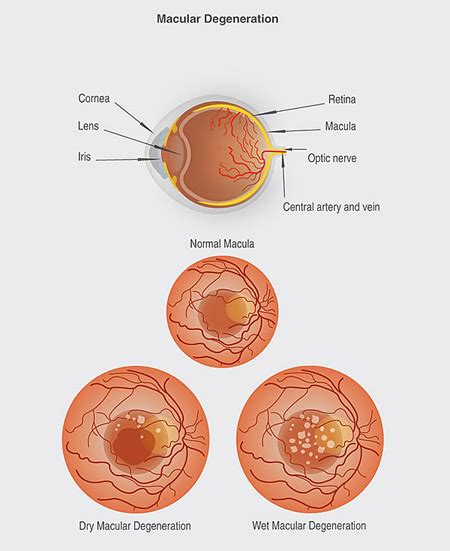 Macula