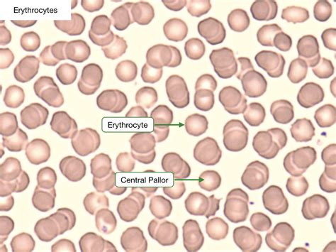 Blood Smears 2020 Lab