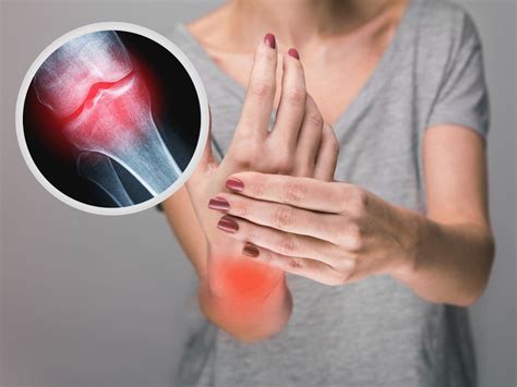 Osteoarthritis Symptoms: 5 Signs Your Joint Pain Could Be Osteoarthritis | TheHealthSite.com