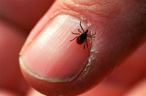 How To Avoid Ticks — And What To Do If You Get Bitten : Shots - Health ...