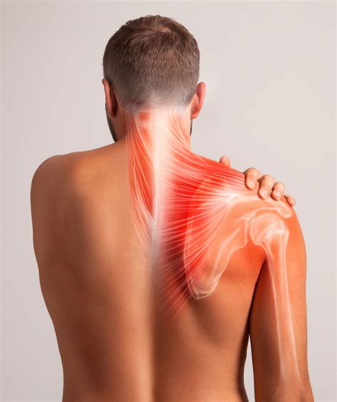 Neck and Shoulder Pain – Matrix Repatterning: Restoring Health From The ...