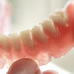 Encinitas Soft Liners for Dentures - Improve oral health with Dr Krueger