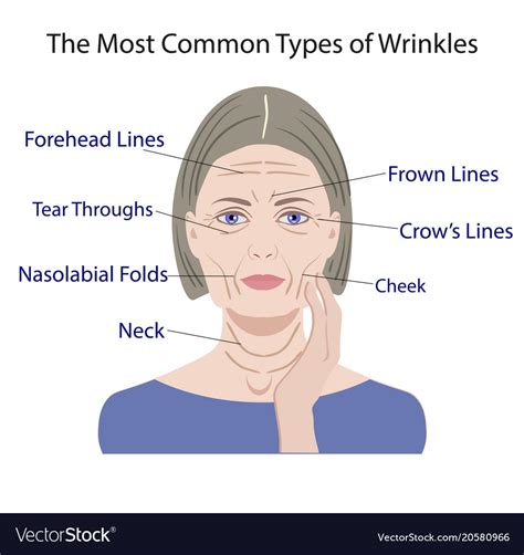 Common types facial wrinkles cosmetic surgery Vector Image