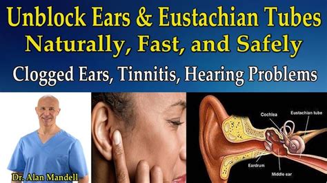 Unblock Ears and Eustachian Tubes Naturally (Clogged Ears, Tinnitis, Hea... | Clogged ears, How ...