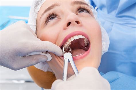 Tooth Extraction; Reasons, Procedure, Before and After