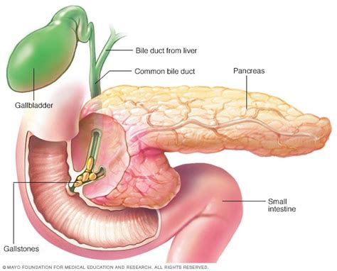 PANCREATITIS – Harumi López