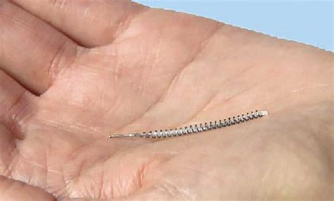 Essure problems cost Bayer $413 million last year alone | Modern Healthcare