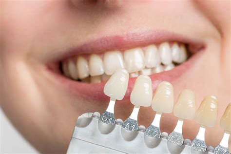 Dental Implants vs. Veneers: What's the Difference | Maryland