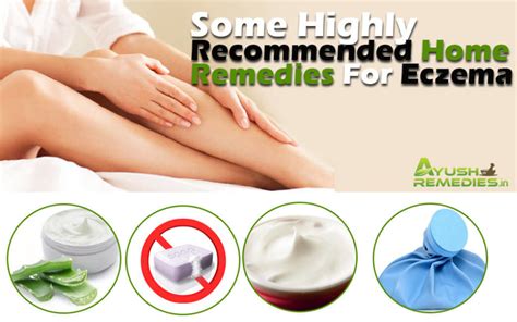 6 Home Remedies For Eczema, Highly Recommended Natural Treatments