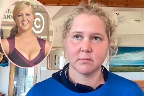 Amy Schumer Shares Shocking Before & After Pics - Warning '20 Somethings' That 'Life Is Coming ...