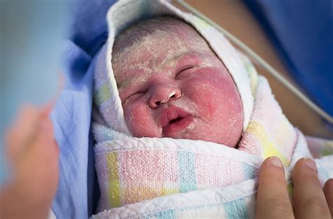 Fakta Seputar Vernix Caseosa pada Bayi Baru Lahir