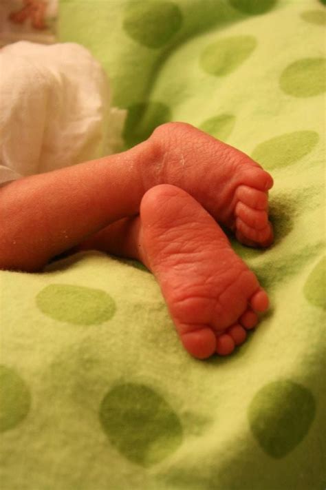 micro preemie feet.. my son brantley Micro Preemie, Preemie Babies, Premature Baby, Neonatal ...