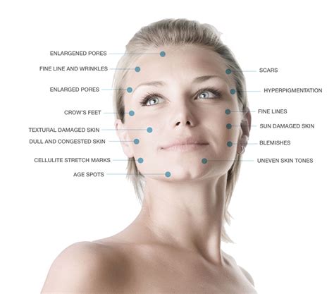 Microdermabrasion Facial - VS MedSpa Skin Clinic in Toronto