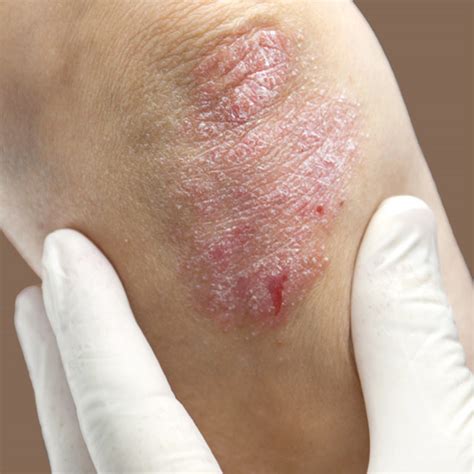 Types Of Skin Problems Types Of Skin Conditions Pictures Photos | Images and Photos finder